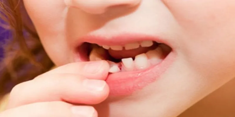 Nằm Mơ Rụng Răng - Giải Mã Những Điềm Báo Đằng Sau Giấc Mơ 2 Những con số tài lộc khi ngủ nằm mơ rụng răng